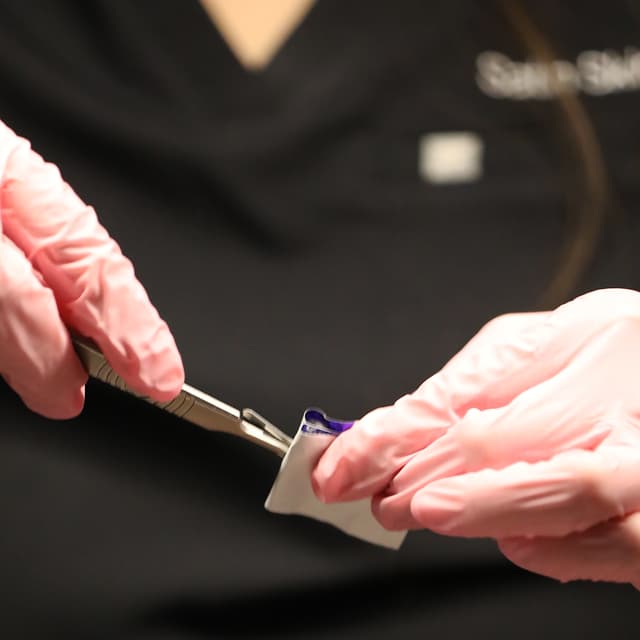 Dermaplaning Package at Satin Skin Esthetics in South Glens Falls, NY